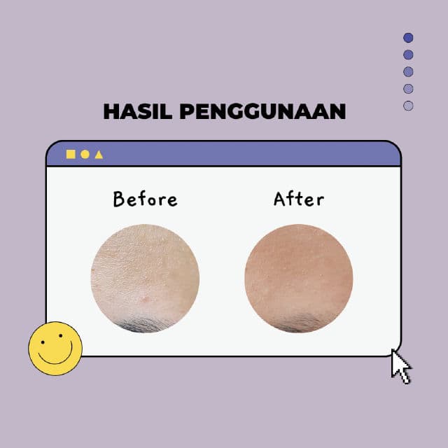 Lacoco en nature 5% Bakuchiol Essence review photo by Bypitek