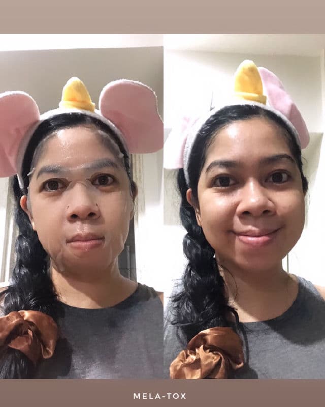 LEADERS Insolution Melatox Mask review photo by Camelliaskinensis