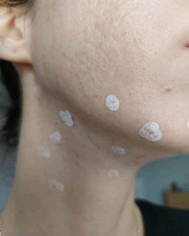 The Plant Base AC Clear Spot Magic Powder  review photo by Chillwithsunscreen