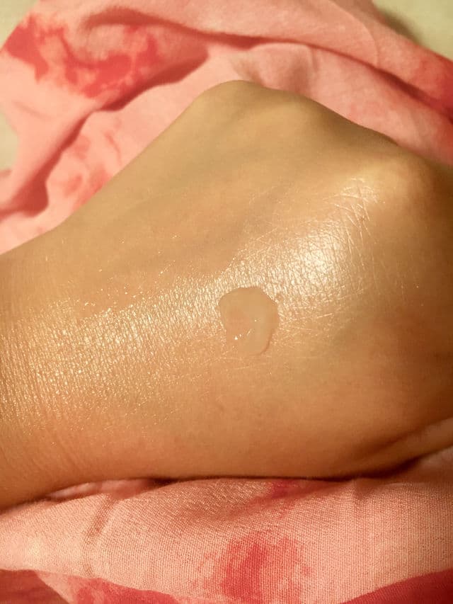 Elixir Cosmeceuticals Niactil 4% review photo by Cornelia