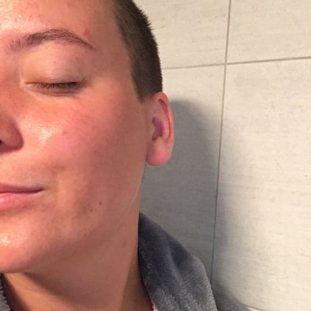 SKIN1004 Madagascar Centella Hyalu-Cica Blue Serum review photo by Cornelia