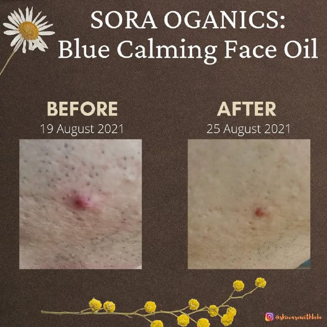Sora Organics Blue Calming Face Oil review photo by Doncaster