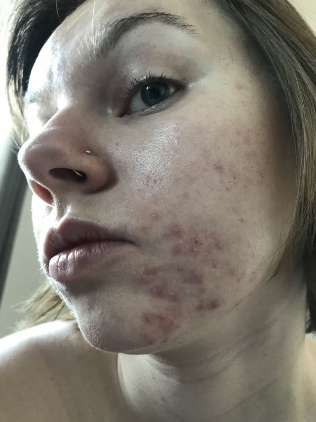 facetheory BHA Exfoliating Serum review photo by Duelly