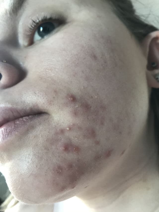 facetheory BHA Exfoliating Serum review photo by Duelly