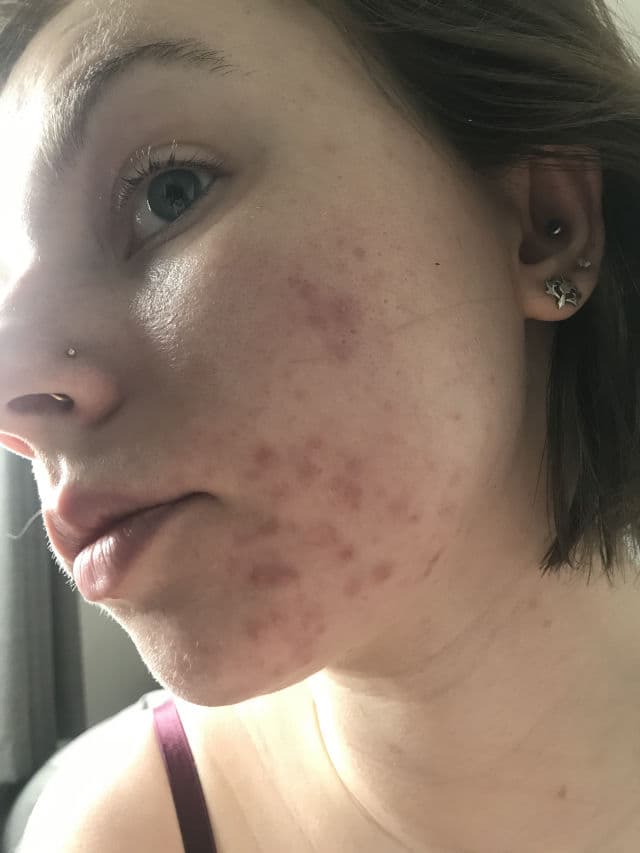 facetheory BHA Exfoliating Serum review photo by Duelly