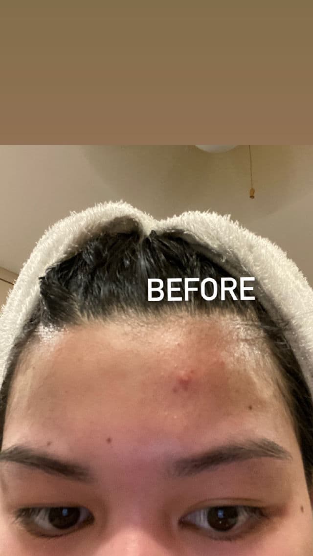 ETUDE AC Clean Up Pink Powder Spot review photo by Elai