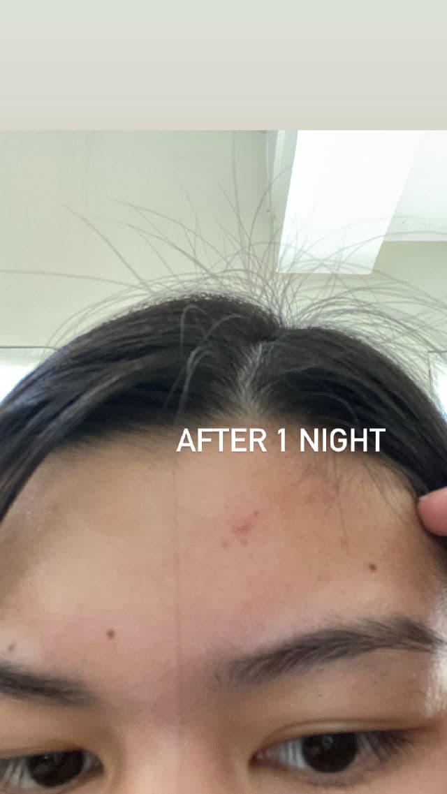 ETUDE AC Clean Up Pink Powder Spot review photo by Elai