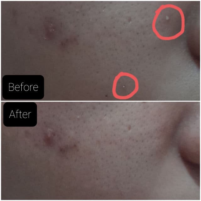 ORGGA French Strawberry Natural Face Mask review photo by Evergarden