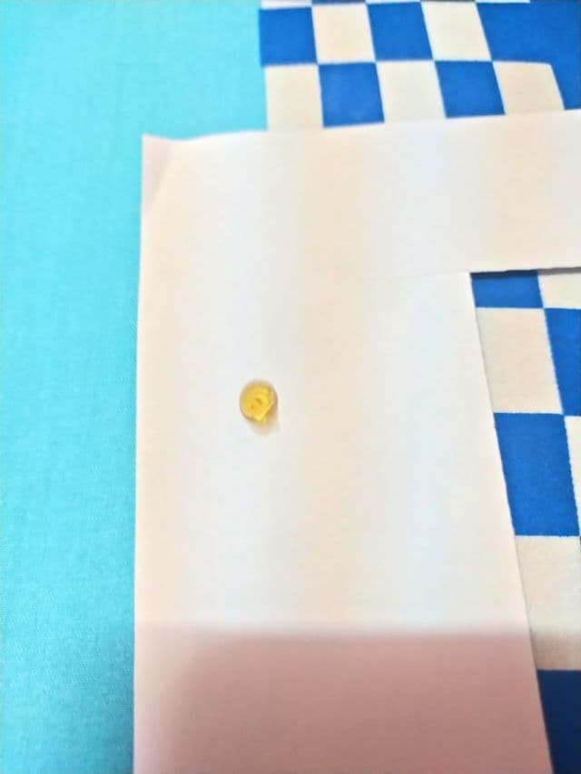 NuTeen I Hate Pimples review photo by Fatynn