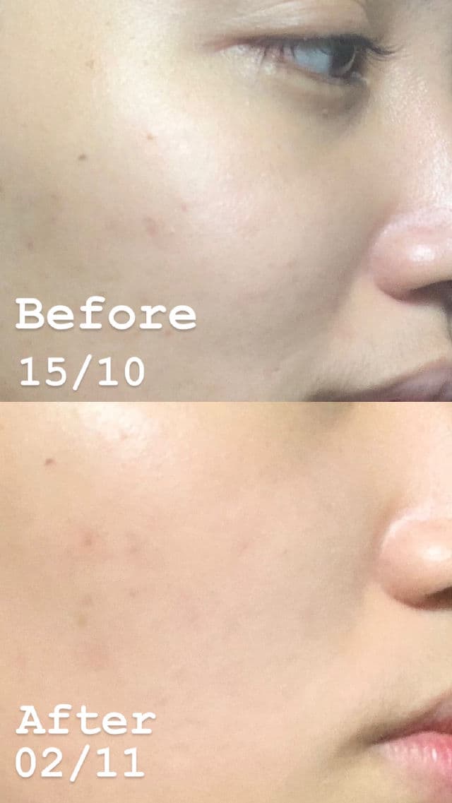 Indoganic Rose Essence C review photo by Formyskinssake