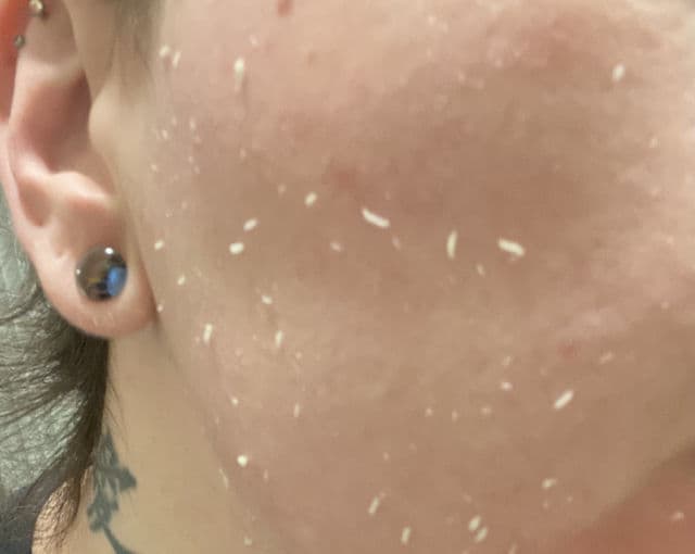 Some By Mi Yuja Niacin Brightening Peeling Gel review photo by GlowWithGia