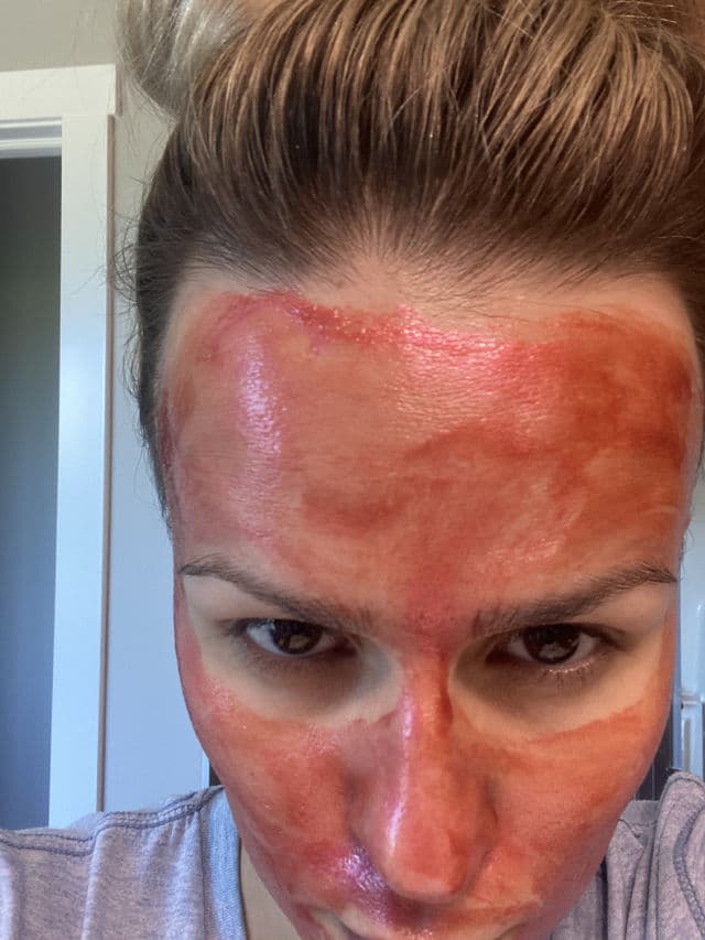 Shiseido Waso: Purifying Peel Off Mask review photo by Glowyforever