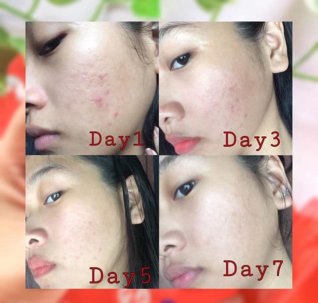 TIAM My Signature Red C Cream review photo by IMOGENE