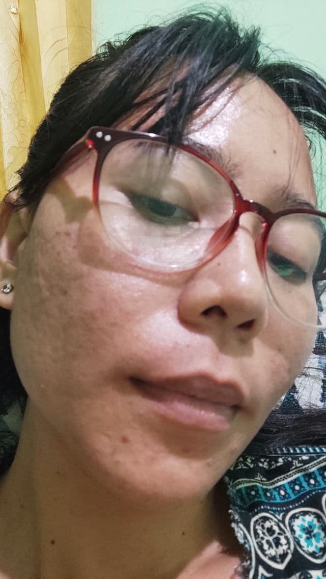 Teratu Beauty Skin Barrier Serum review photo by Indahtrk