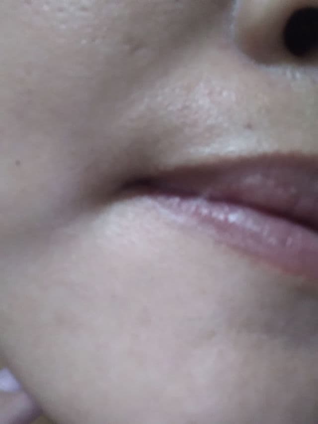 TRUEVE BHA & CICA Acne Serum review photo by Indrimauliddiyah