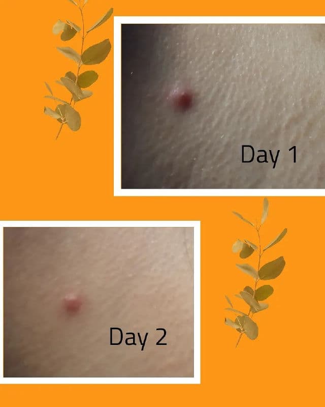 BELLAMONSTER Stress Out Solution A-Clear Spot Cream review photo by IssaMarie