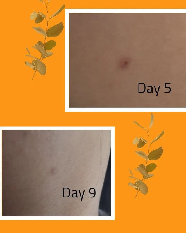 BELLAMONSTER Stress Out Solution A-Clear Spot Cream review photo by IssaMarie