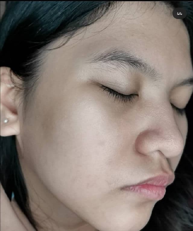 SECRET KEY Starting Treatment Eye Cream Rose Edition review photo by Jhoannaaxx