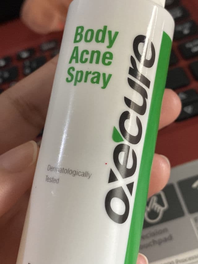 Oxecure Acne Spray review photo by KAROL