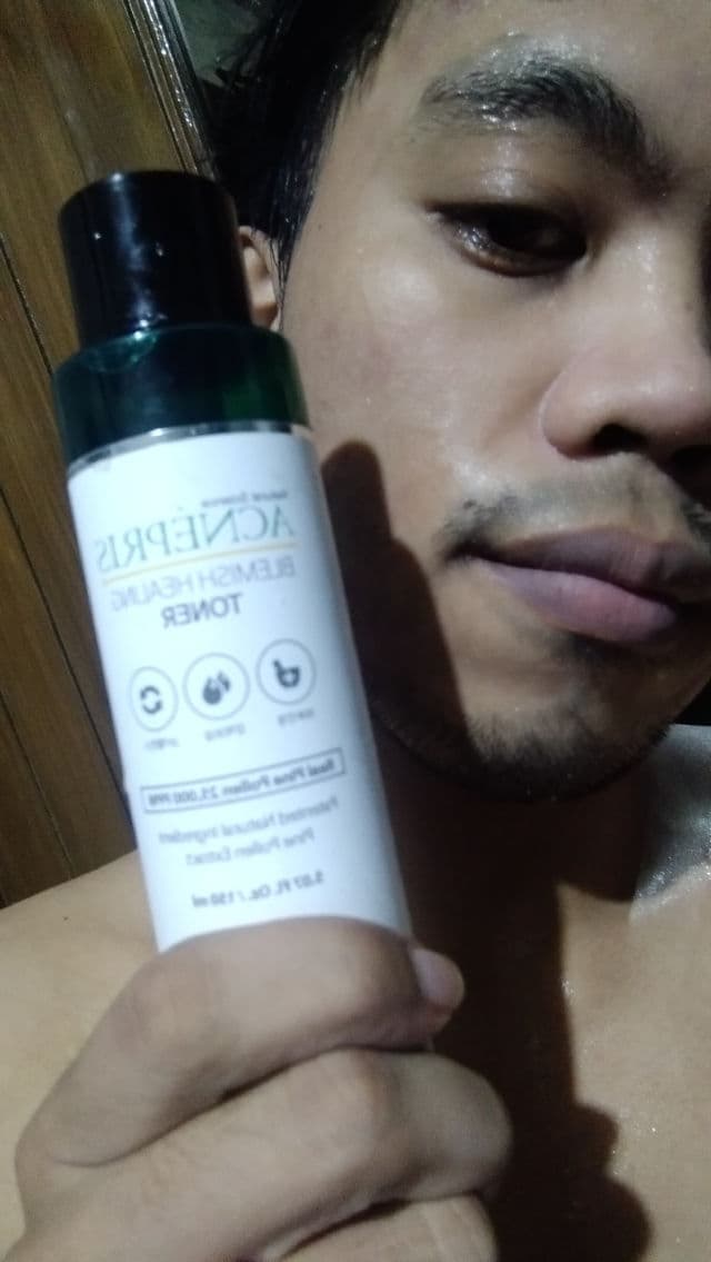 Biolee Laboratory Acnepris Blemish Healing Toner review photo by Katho