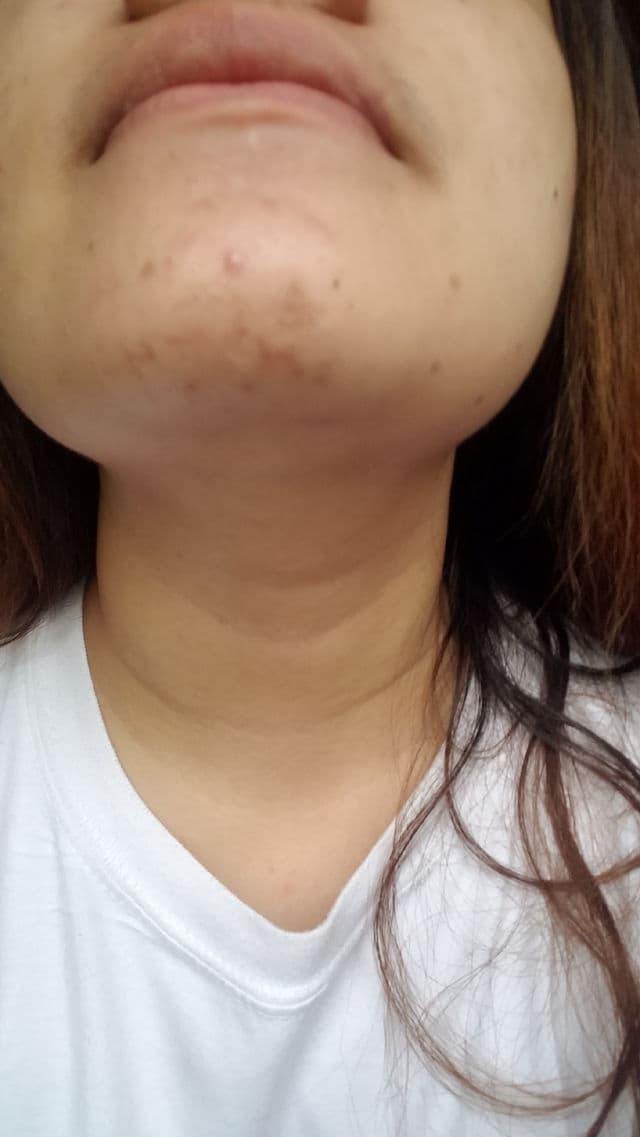 Laikou California Vitamin C Serum review photo by Kem