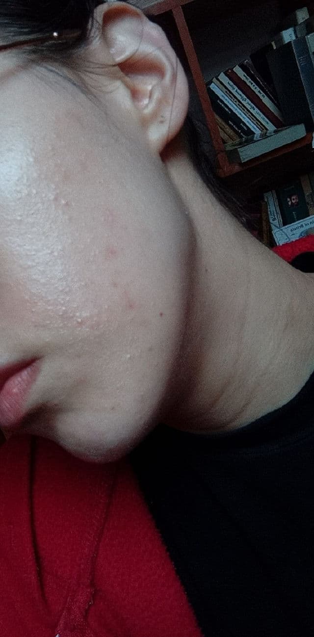 La Roche-Posay Shaka Fluid SPF50+ review photo by Kincs