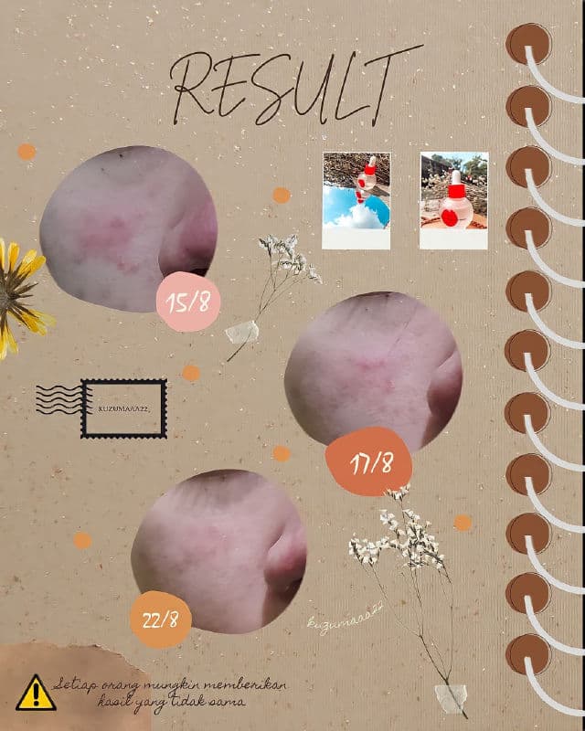 Dear Me Beauty 10% Niacinamide + Watermelon Extract Face Serum review photo by Kusuma