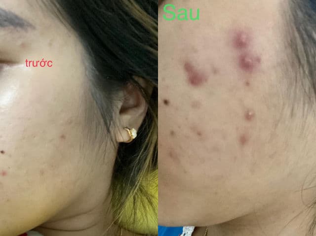 Kiehl's Clearly Corrective Brightening & Smoothing Moisture Treatment review photo by KellyWong