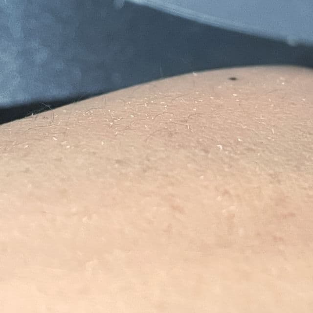 Chantecaille Bio Lifting Serum+ review photo by LYnnsssss