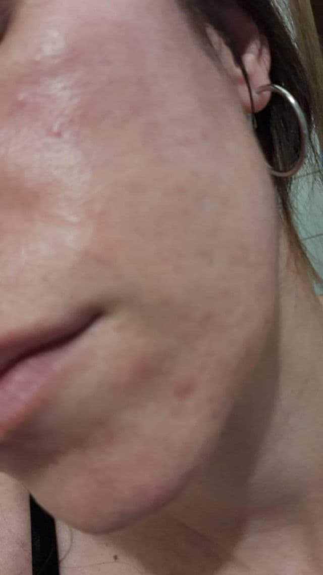 Some By Mi Snail Truecica Miracle Repair Cream review photo by LetsTalkBeauty