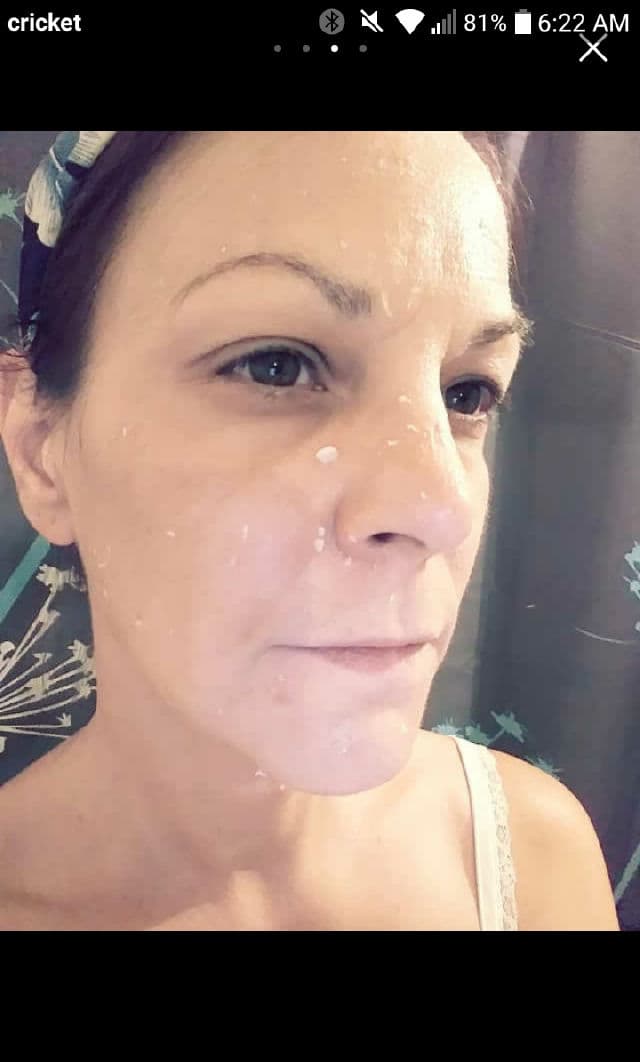 BENTON PHA Peeling Gel review photo by Lorelei