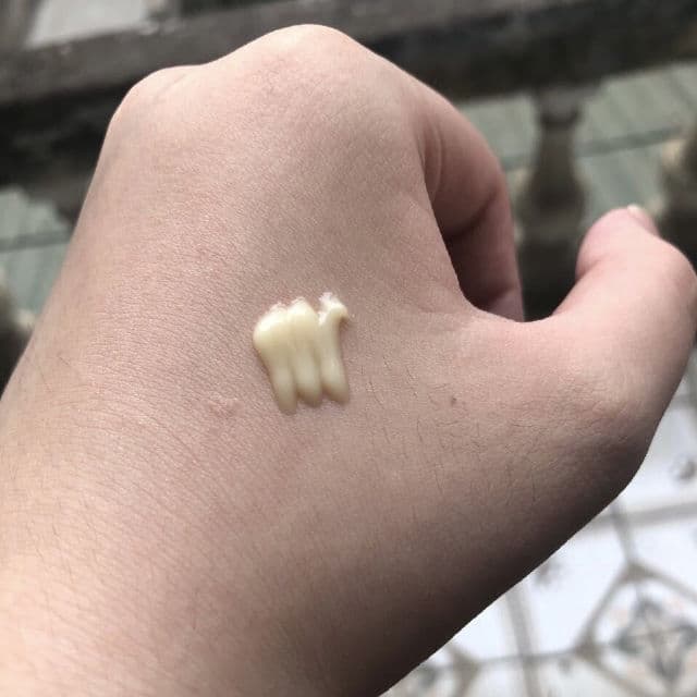 Eucerin Pro Acne A.I Clearing Treatment review photo by LynnnReview