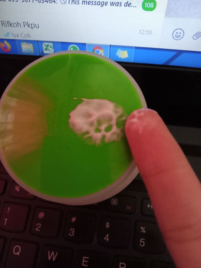 Safi White Natural Anti Acne Cream Tea Tree review photo by Mariapaquita92