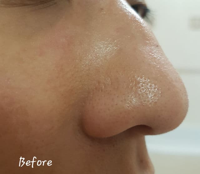 Paula's Choice Skin Balancing Pore-Reducing Toner review photo by Meg908