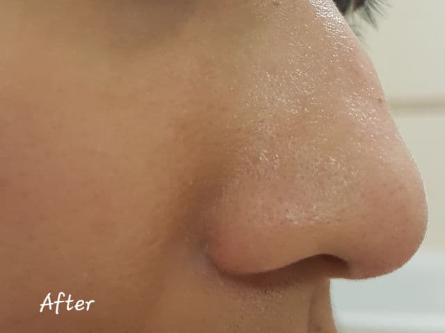 Paula's Choice Skin Balancing Pore-Reducing Toner review photo by Meg908