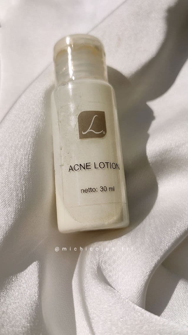 Larissa Acne Lotion review photo by Michico