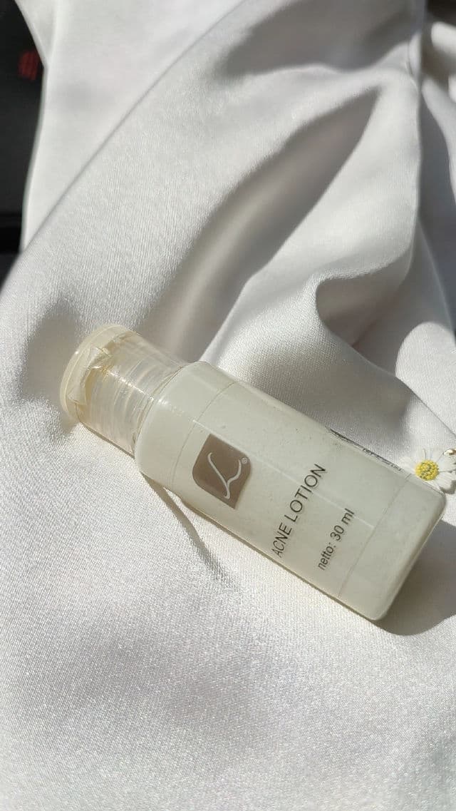 Larissa Acne Lotion review photo by Michico