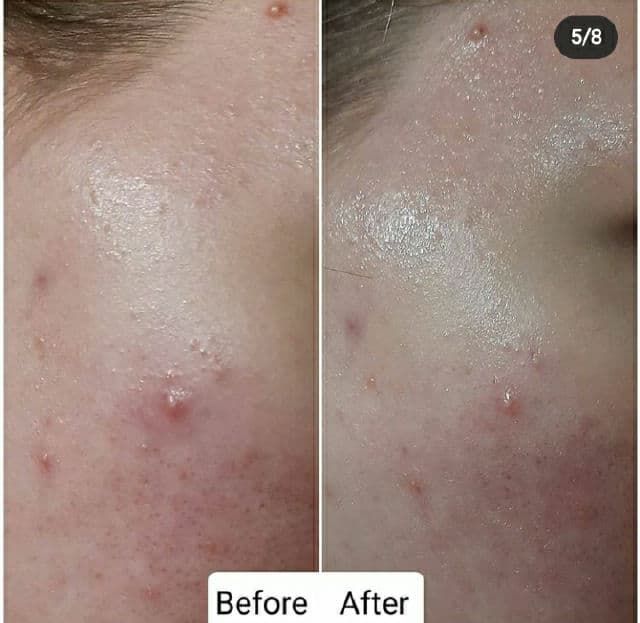 Rovectin Dr. Mask Cica review photo by Mimi09