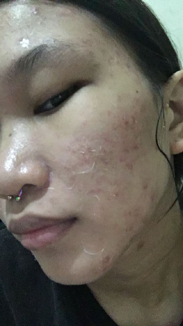 Ryx Skincerity CLEAR BOMB Advanced Exfoliating Kit - Advanced Exfoliating Soap review photo by MonikeeChan