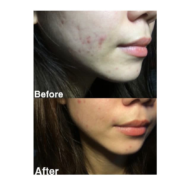 Loomi Skincare Centella Asiatica Extract review photo by Mooi