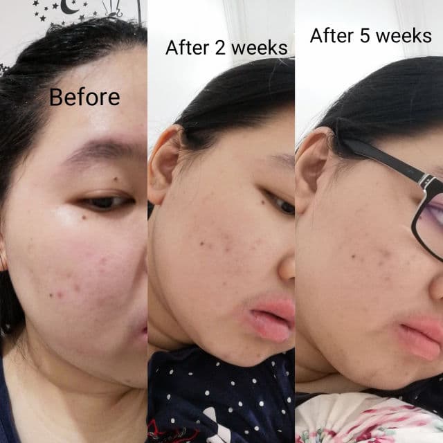 Garnier Skin Naturals - Pure Active Multi-Action Toner review photo by Muziz