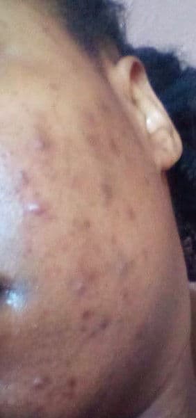 Garnier Oil Control Complete Deep Cleansing Lotion review photo by NMWAH