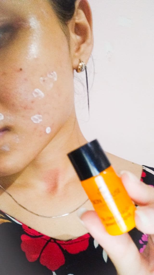 The Skin House Dr. Clear Magic Powder Spot review photo by Narezngrez