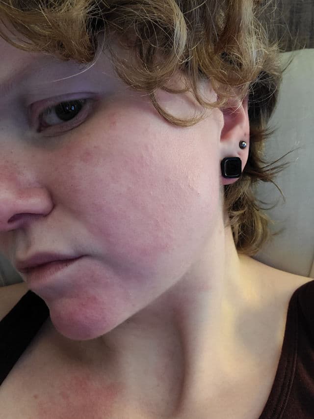 Biossance Squalane + Vitamin C Rose Oil review photo by NatRose