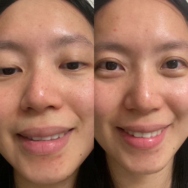 Donginbi Red Ginseng Moisture & Balancing Softener review photo by NguyenAndOngLy