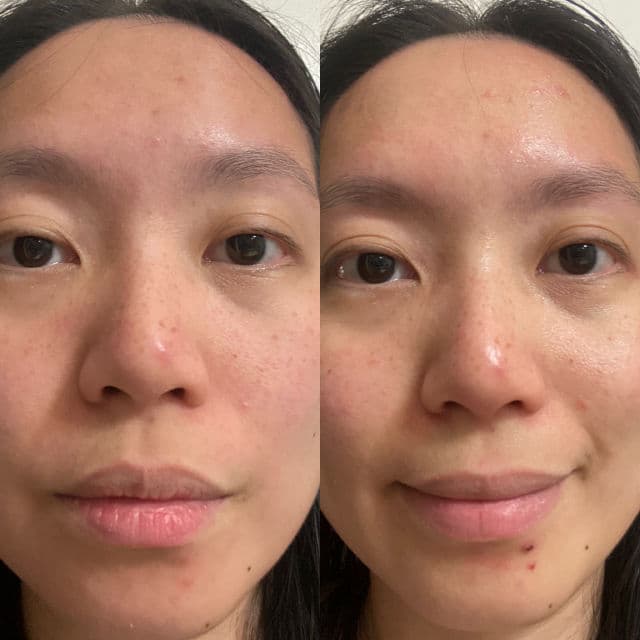 Donginbi Red Ginseng Moisture & Balancing Emulsion  review photo by NguyenAndOngLy