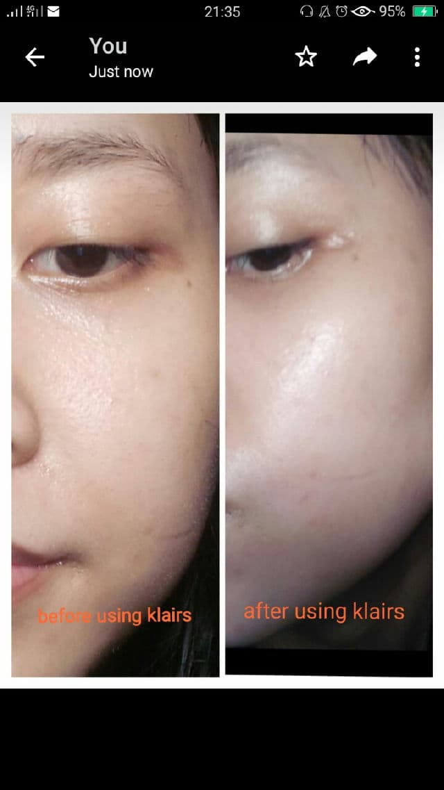 Dear, Klairs [Discontinued] Soft Airy UV Essence review photo by Niacinaemide