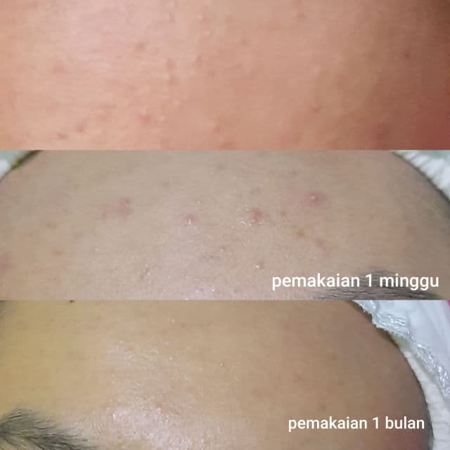 Kleveru Glass Skin Overnight Serum review photo by Nrmlapw