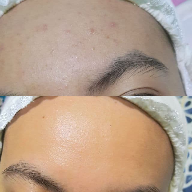 Kleveru Glass Skin Overnight Serum review photo by Nrmlapw