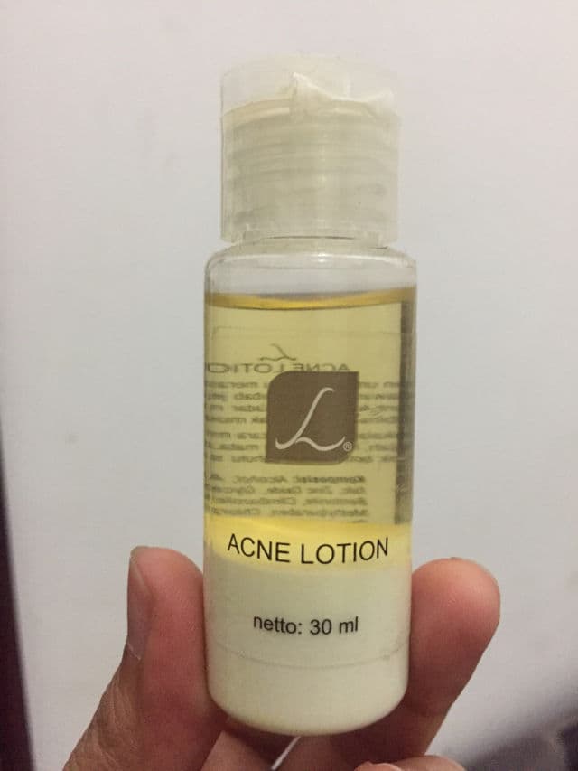 Larissa Acne Lotion review photo by Oktaviaa
